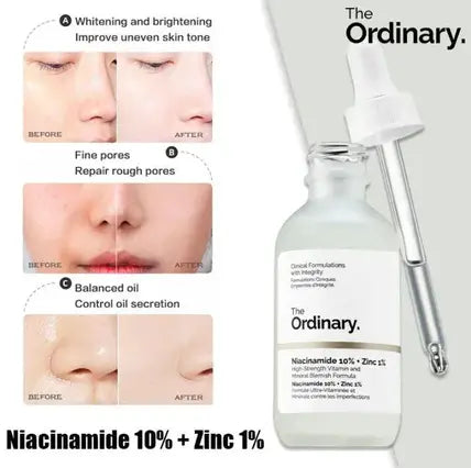 The Ordinary Niacinamide Serum Glowtrends